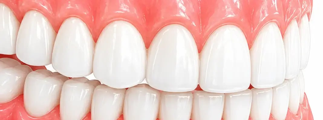 Dentures_tagdental_media