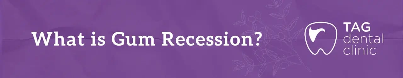 What is Gum Recession