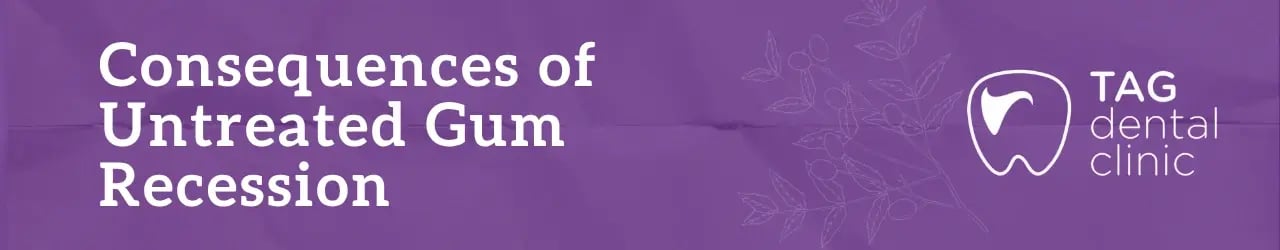 Consequences of Untreated Gum Recession