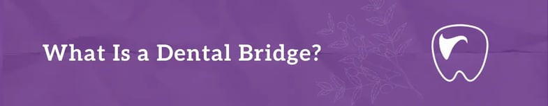 What Is a Dental Bridge