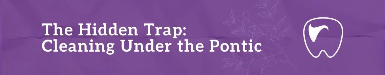 The Hidden Trap: Cleaning Under the Pontic