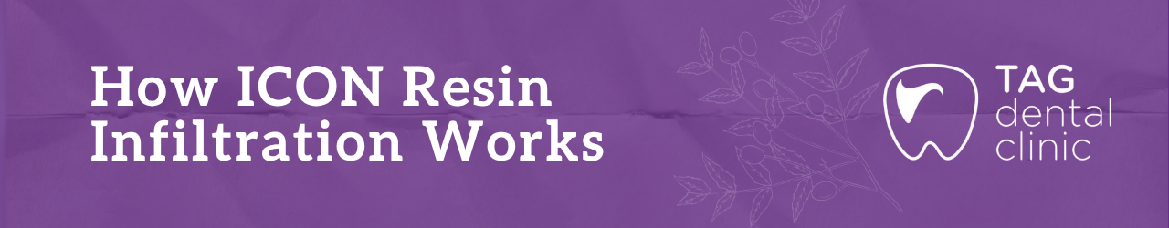 How ICON Resin Infiltration Works