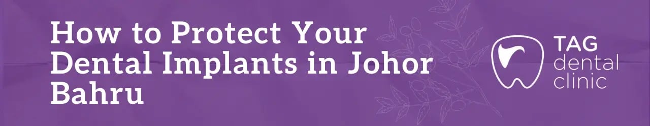 How to Protect Your Dental Implants in Johor Bahru