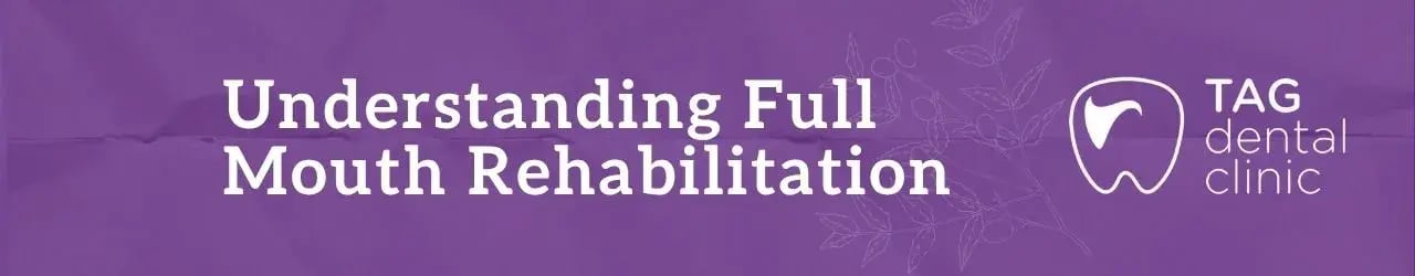 understanding-full-mouth-rehabilitation