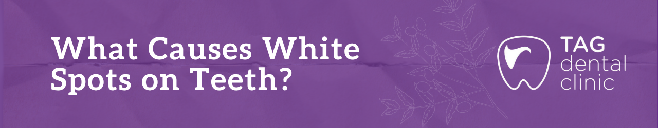 What Causes White Spots on Teeth