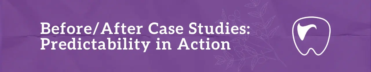 BeforeAfter Case Studies Predictability in Action