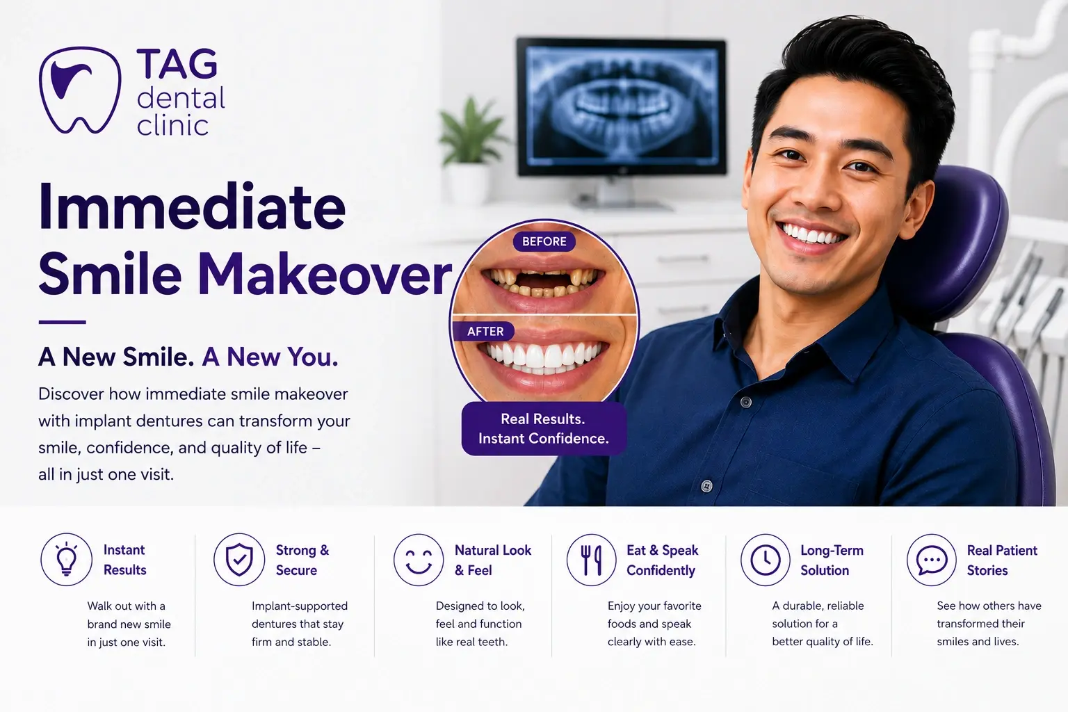 smile-makeover