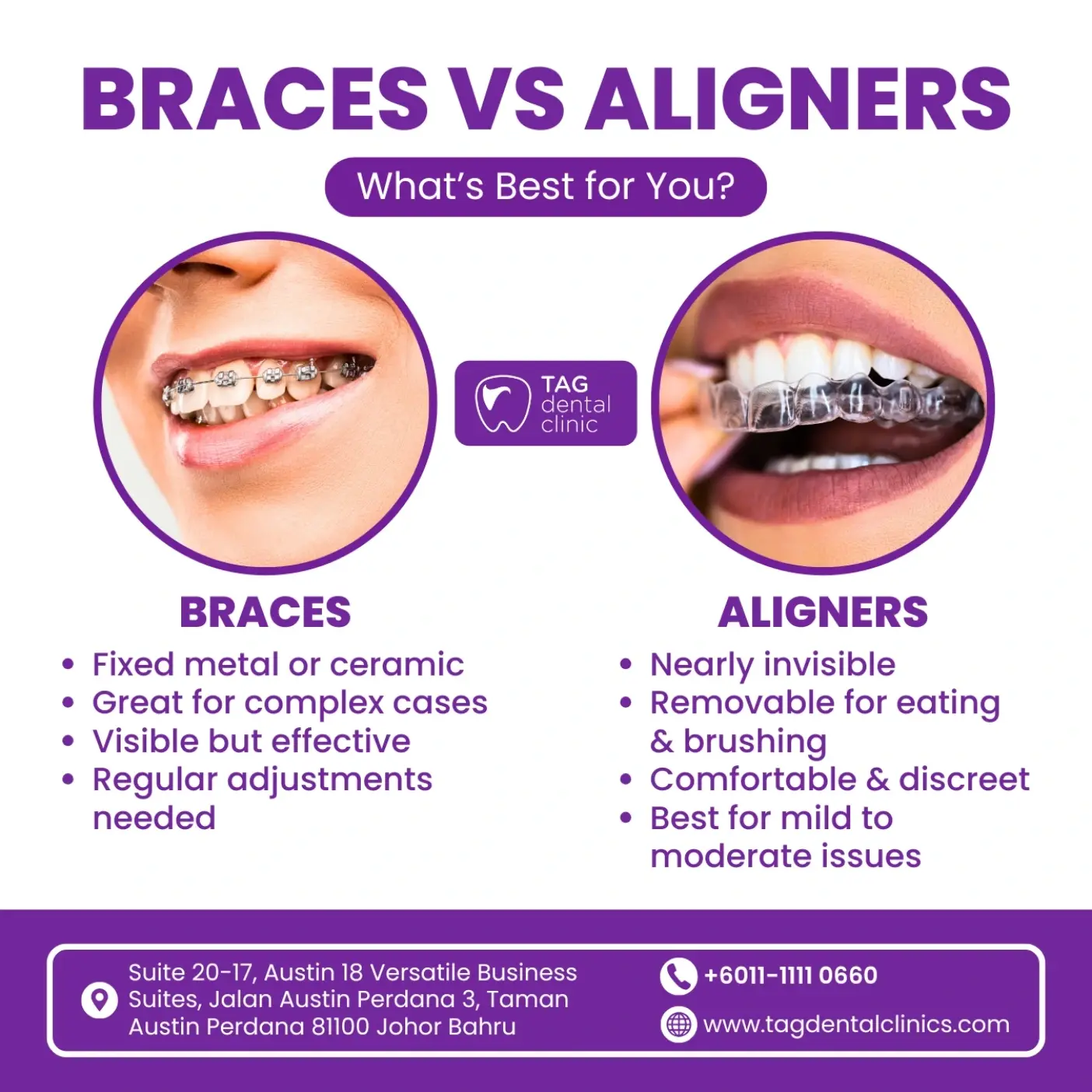 Orthodontic Treatment in Johor Bahru