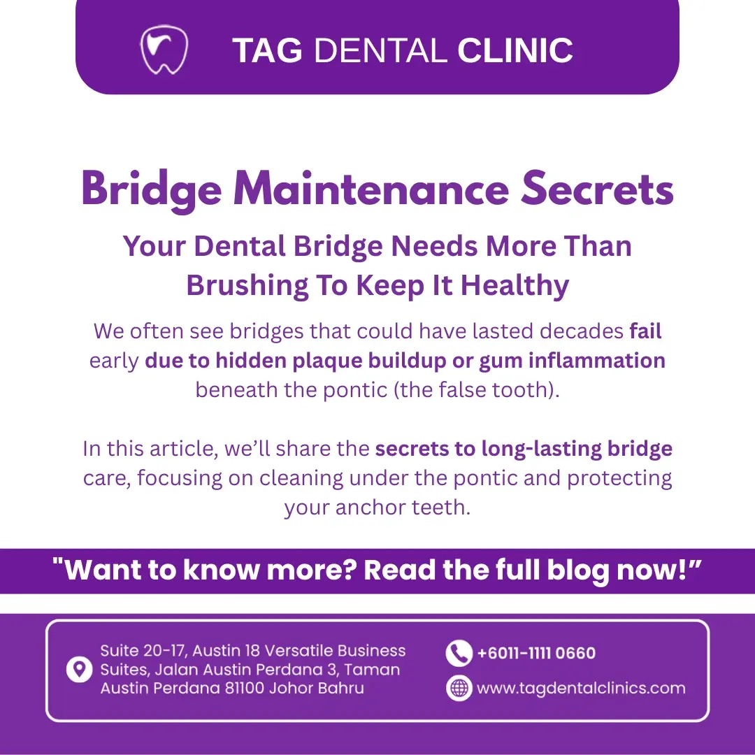 Single Post Thumbnail