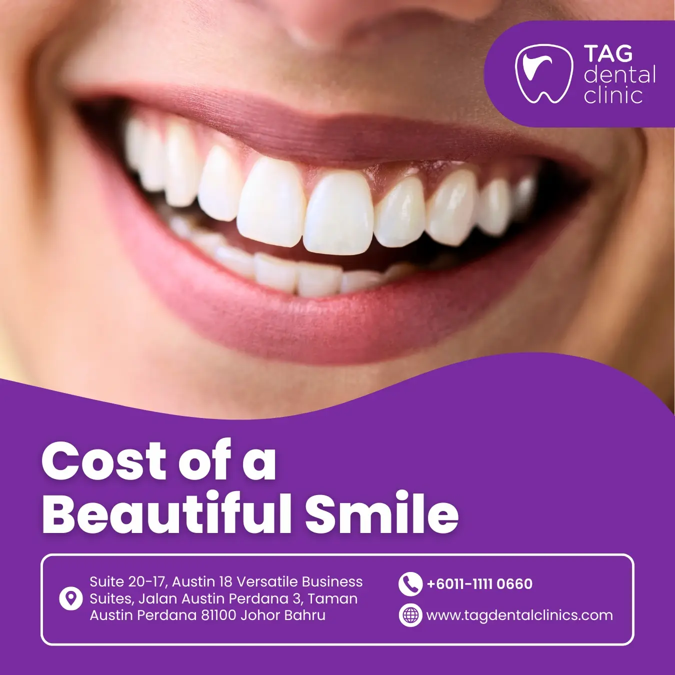 Worried About the Cost of a Beautiful Smile in Johor Bahru