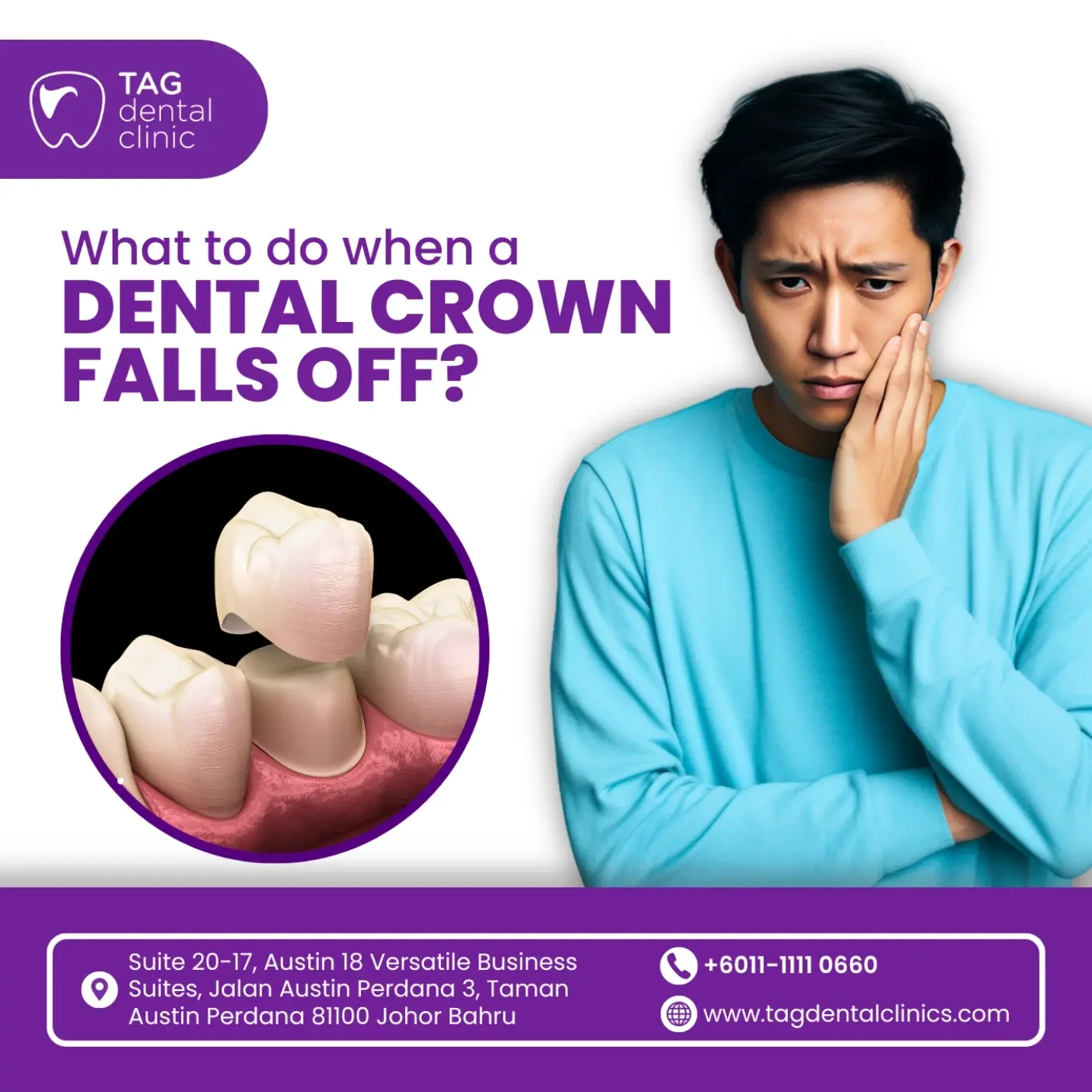 Dental Crowns in Johor Bahru