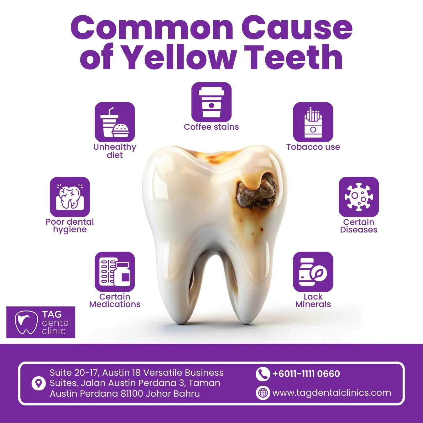 Complete Dental Care Guide for Expats Living in Johor Bahru