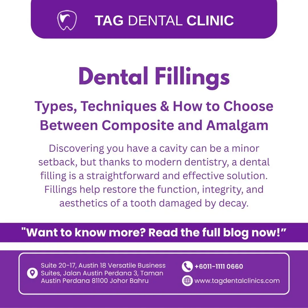 Dental Fillings in Johor Bahru