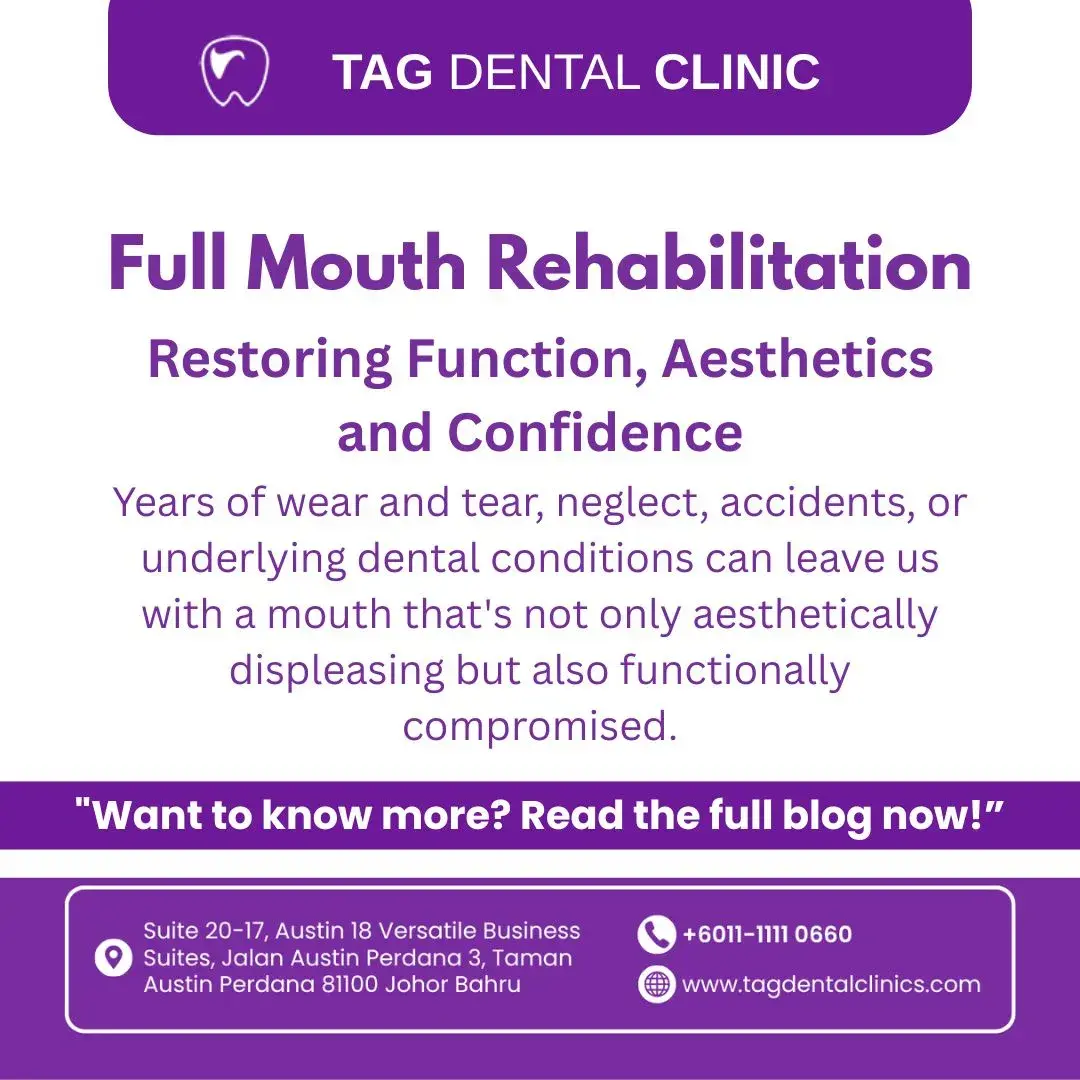 Full Mouth Rehabilitation in Johor Bahru