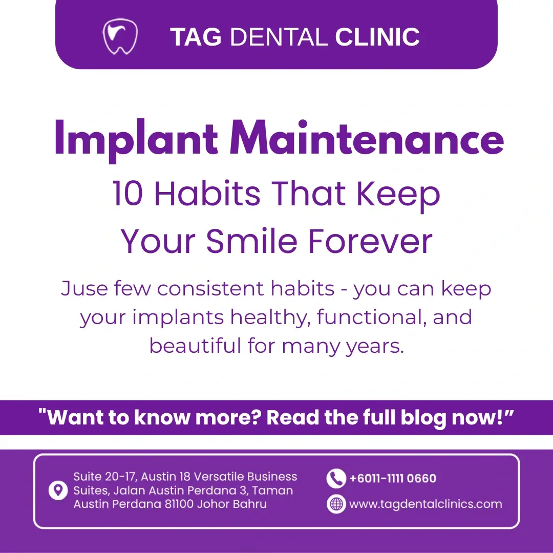 Implant Maintenance Made Easy: 10 Habits That Keep Your Smile Forever