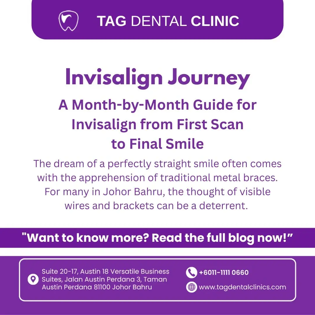 Invisalign Journey