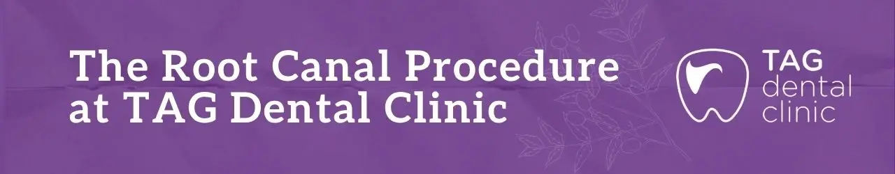 The Root Canal Procedure
