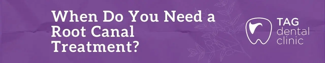 Root Canal Treatment