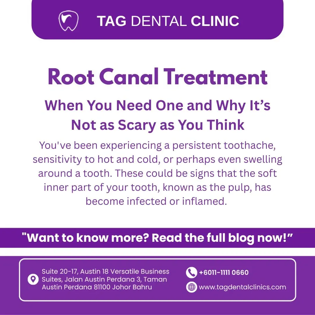 Root Canal Treatment in Johor Bahru