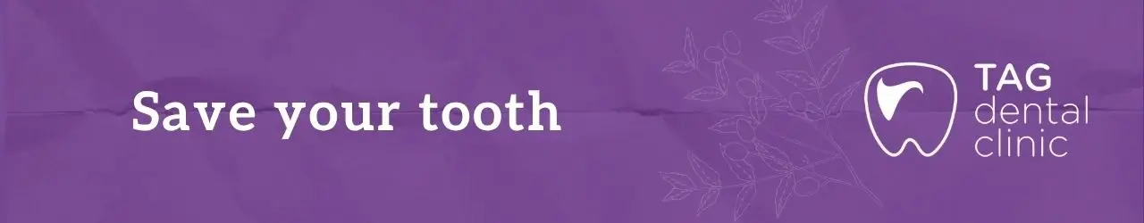 saving your tooth