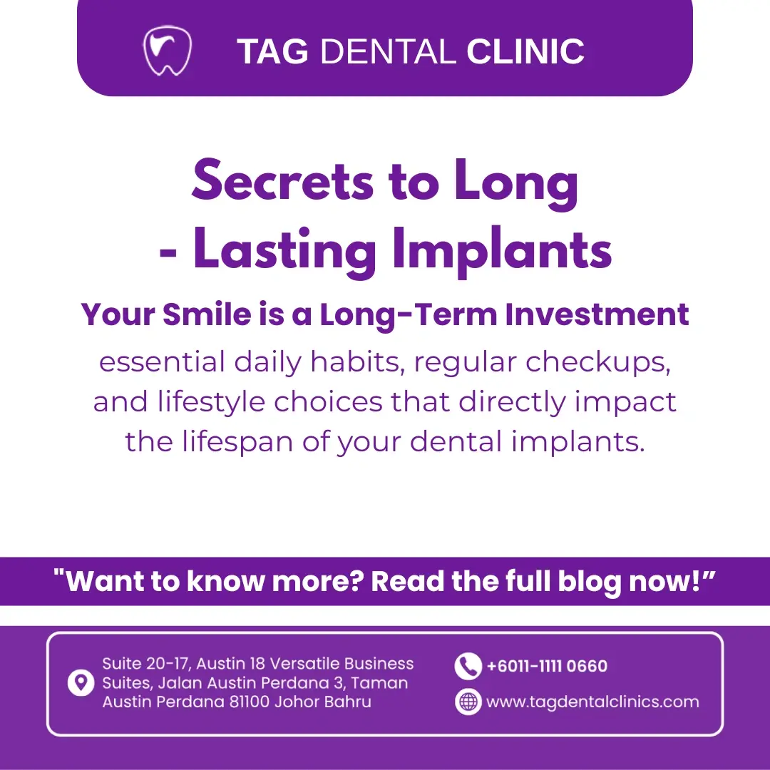 Secrets to Long-Lasting Implants: Habits that Help Them Last a Lifetime
