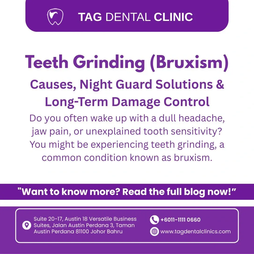 Teeth Grinding (Bruxism) in JB