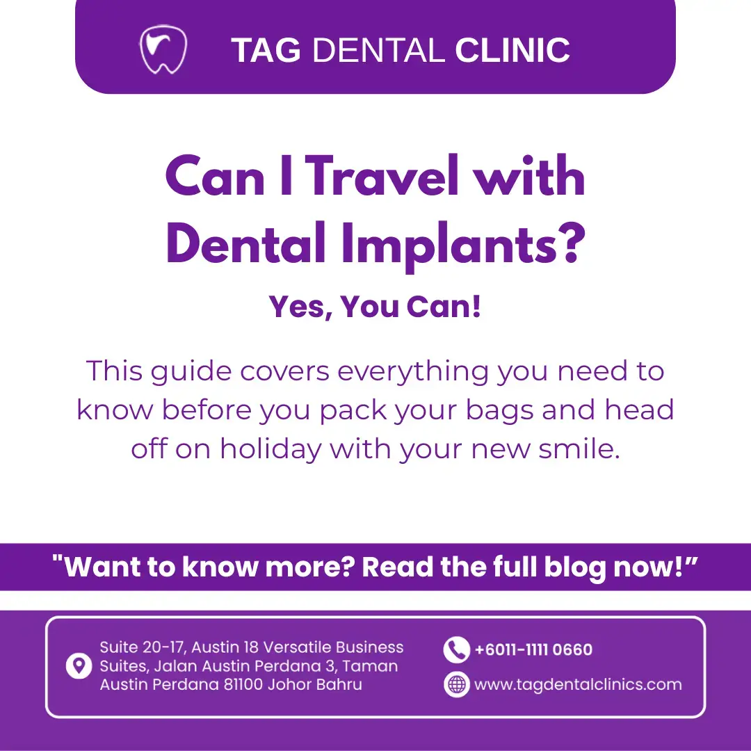 Can I Travel with Dental Implants? A Malaysia's Guide to Holidays & Hygiene