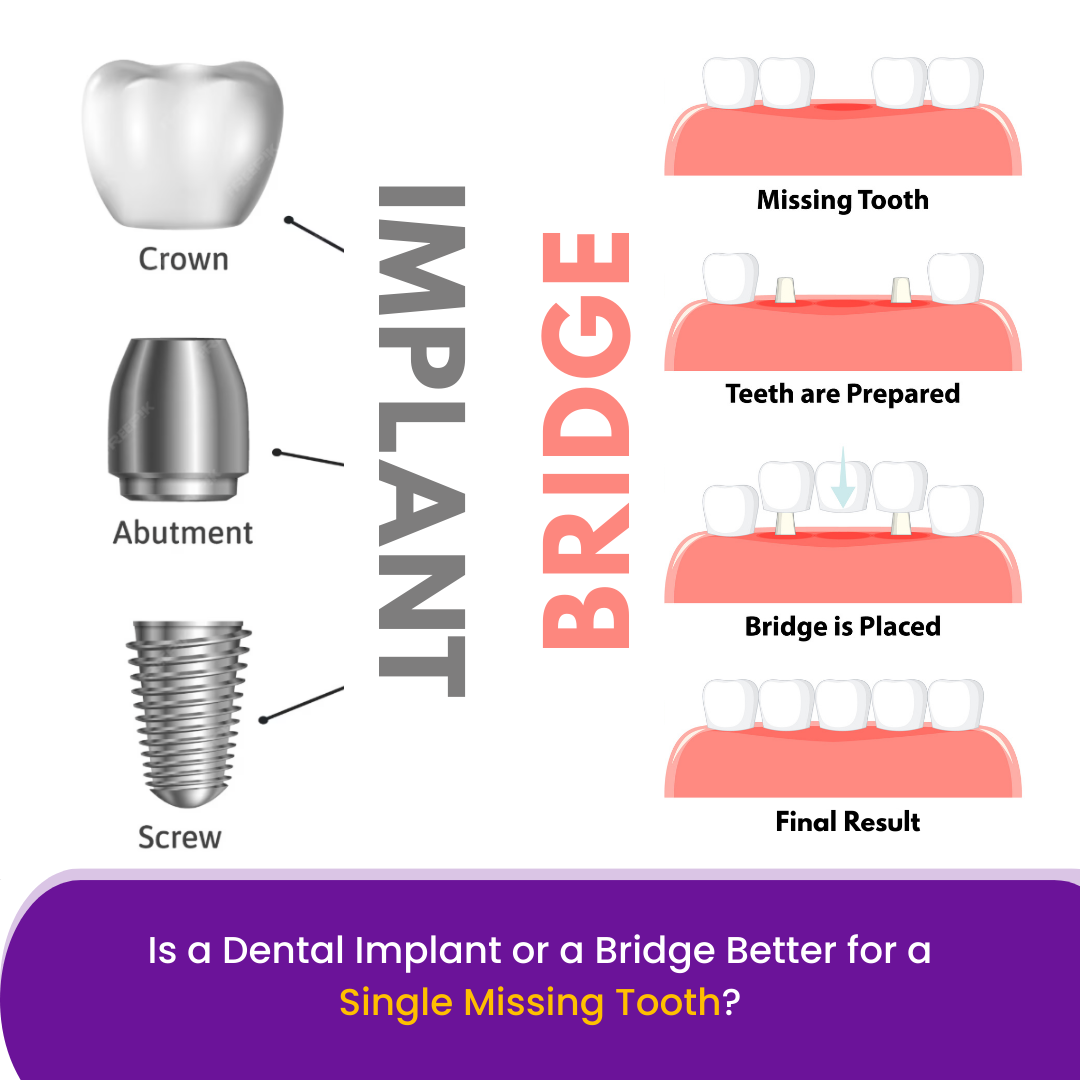 Single Post Thumbnail