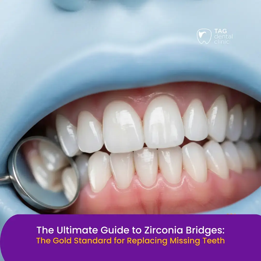 Single Post Thumbnail